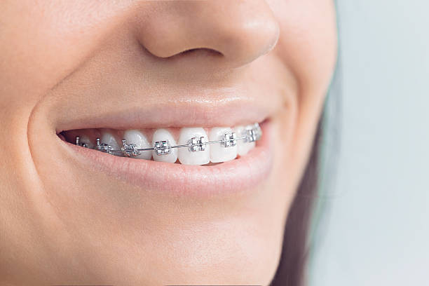 Best Dental Inlays and Onlays  in Saratoga Springs, NY